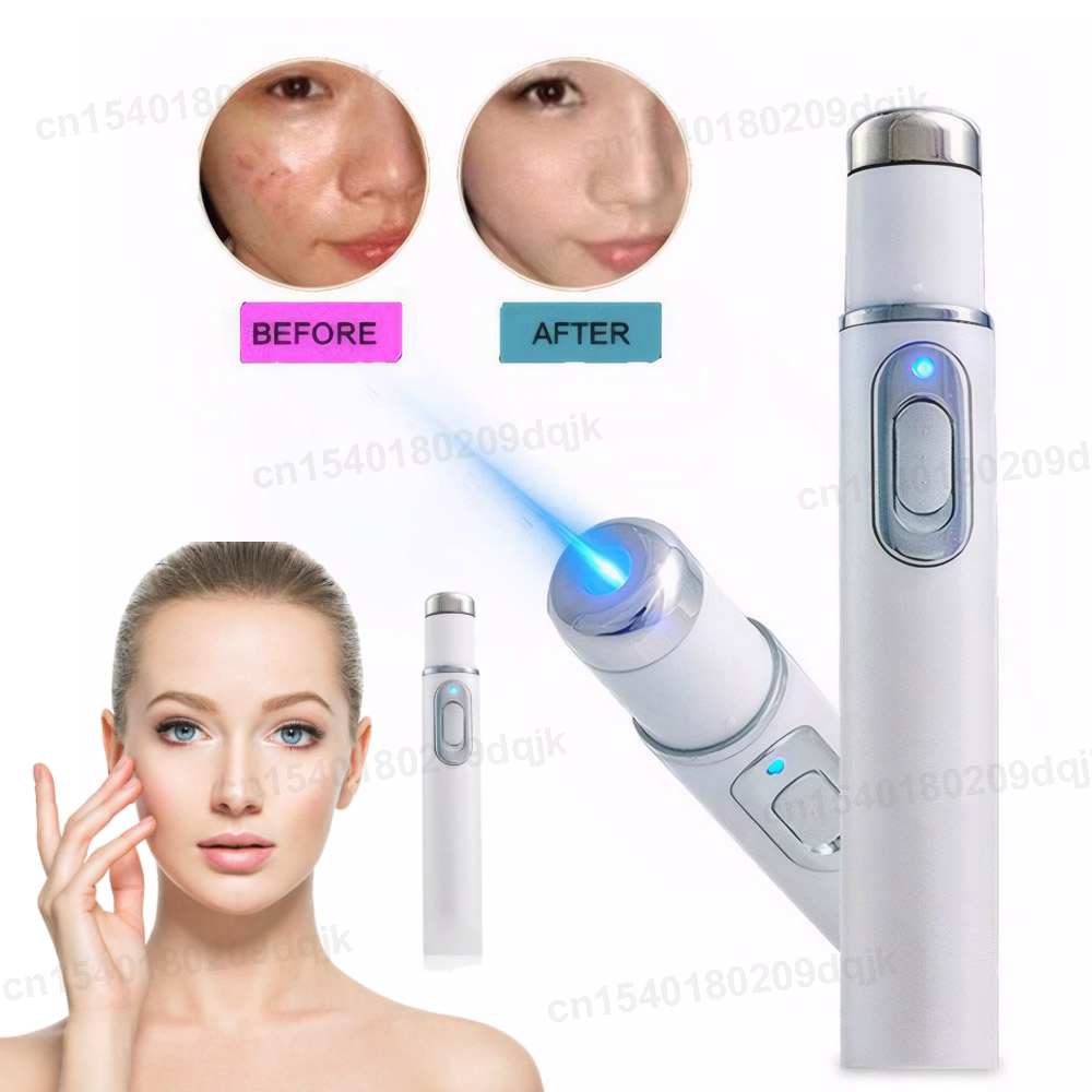 Terapia de luz azul, pluma par - Acne Light Therapy Pen reseña y precio