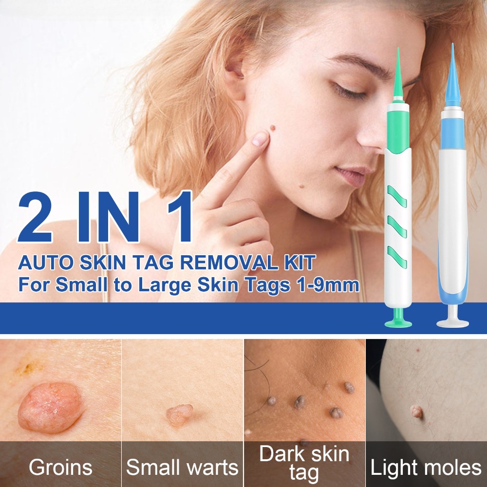 Kit de herramientas de elimina - Acne Light Therapy Pen reseña y precio