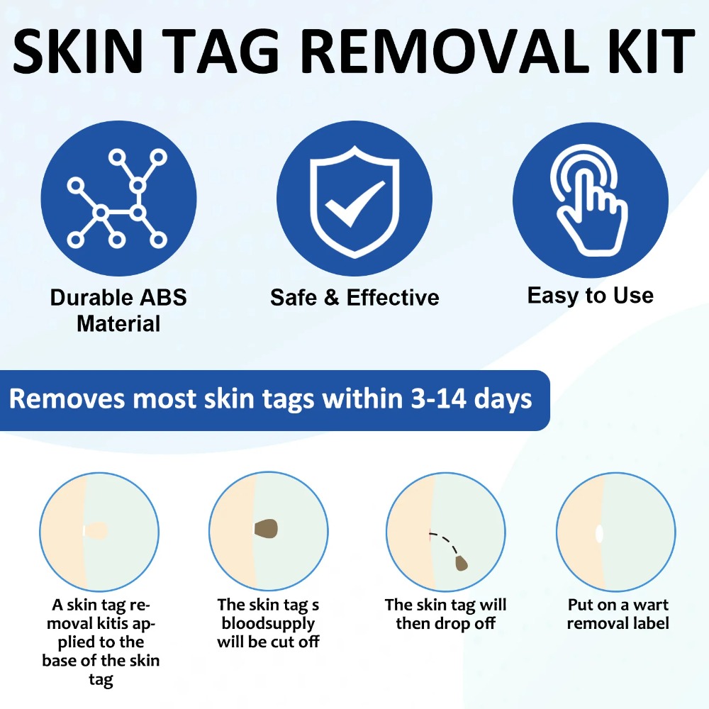 Kit de herramientas de elimina - Acne Light Therapy Pen reseña y precio